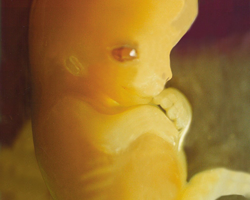 Embrión humano de 7 semanas
